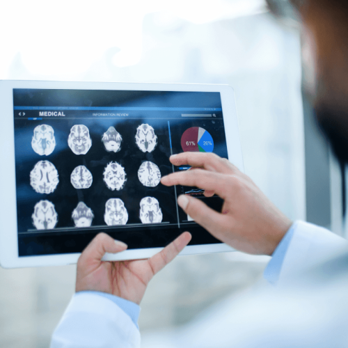 How Addiction Affects the Brain: A Simple Explanation